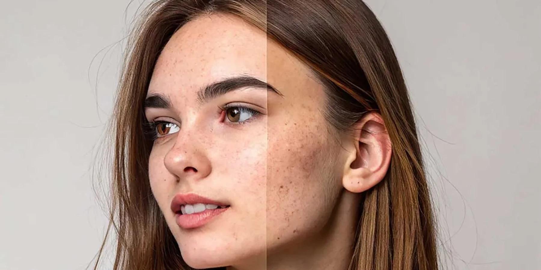 Spot Care: Solutions for Uneven Skin Tone with SnowCell