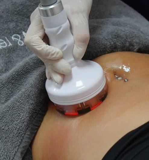 Magic Shape Nedir? Bölgesel İncelme Teknolojisi ve Faydaları