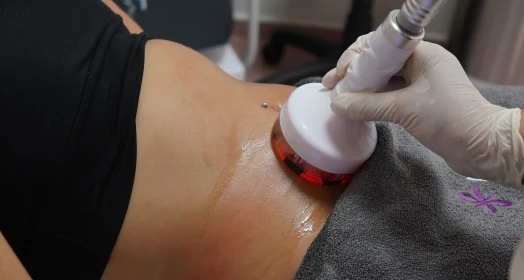 What Is Magic Shape? Effects on Belly and Leg Slimming