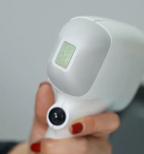 Buz Lazer Epilasyon: Smart Diode ile Acısız ve Etkili Çözüm