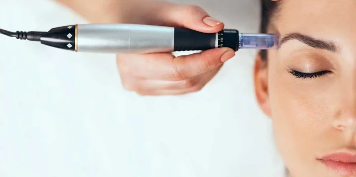 Dermapen Uygulamasının Etkileri: Gerçekten Etkili mi?