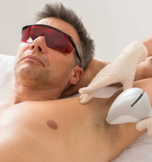 Erkek Lazer Epilasyon Rehberi: Kıl Yapısı ve Bölgelere Özel Çözümler