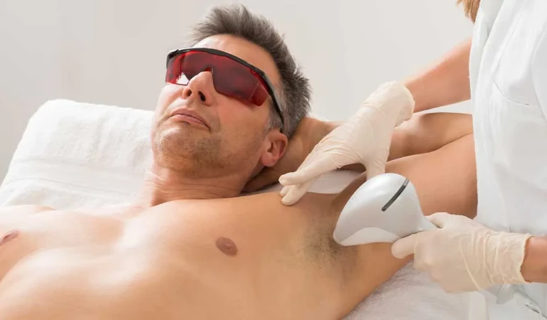 Men’s Hair Removal Guide: Targeted Laser Treatments and Managing Concerns