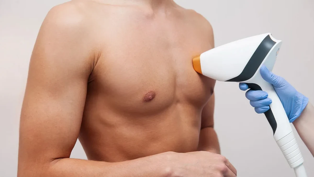 Men’s Laser Hair Removal: Effective and Safe Treatments