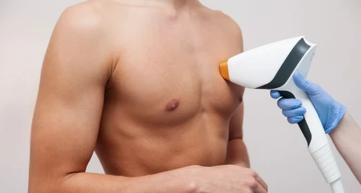 Erkek Lazer Epilasyon: Kalıcı Çözümler ve Güvenli Uygulamalar