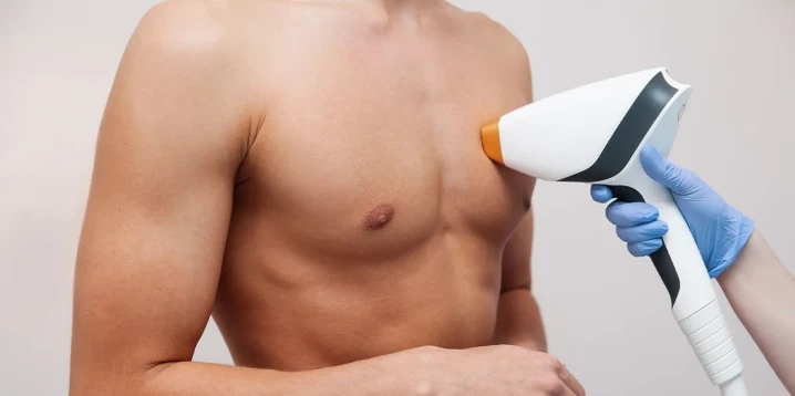 Erkek Lazer Epilasyon: Kalıcı Çözümler ve Güvenli Uygulamalar