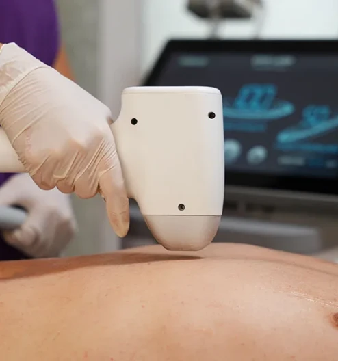 Erkek Lazer Epilasyon: Kalıcı Konfor İçin Uygulama Rehberi