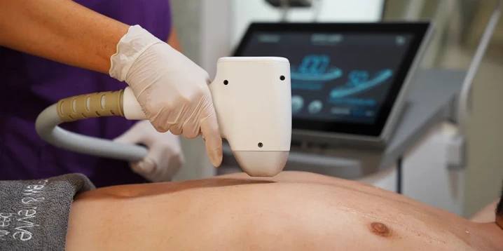 Men’s Laser Hair Removal: A Guide to Lasting Comfort