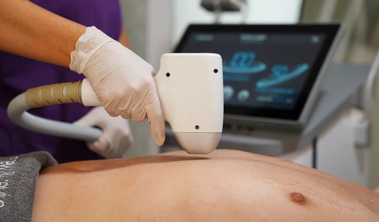 Men’s Laser Hair Removal: A Guide to Lasting Comfort