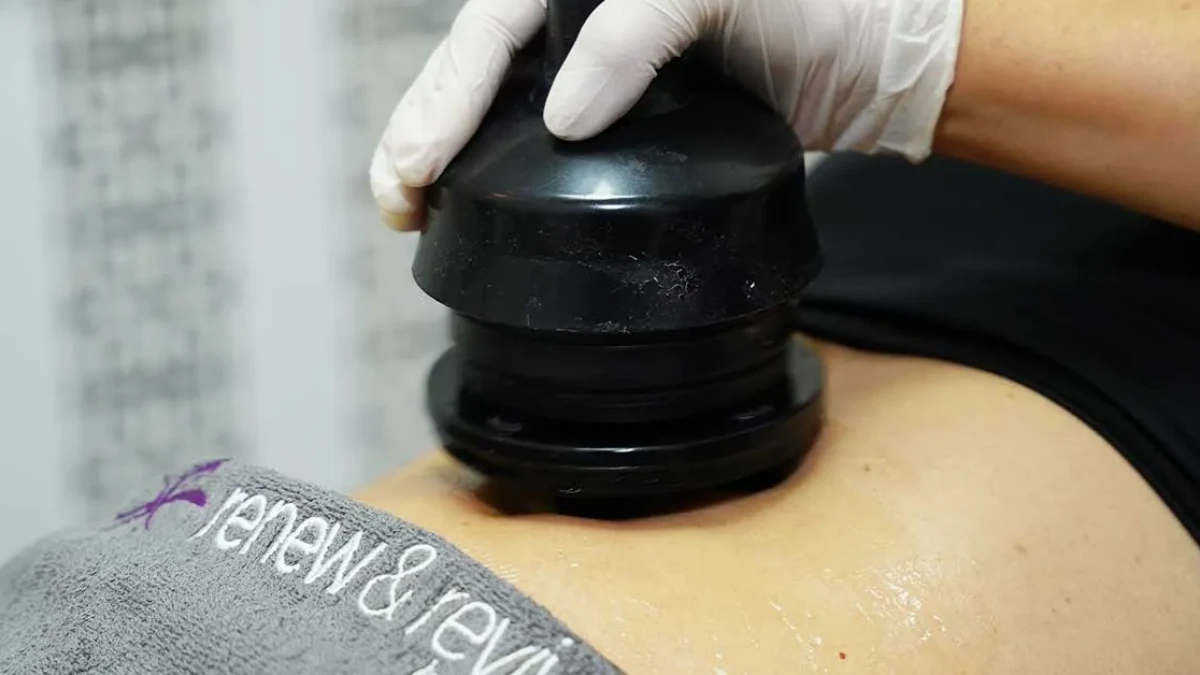 Benefits of G5 Massage: Cellulite Reduction & Body Contouring