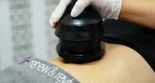 Benefits of G5 Massage: Cellulite Reduction & Body Contouring