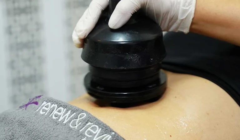 Benefits of G5 Massage: Cellulite Reduction & Body Contouring