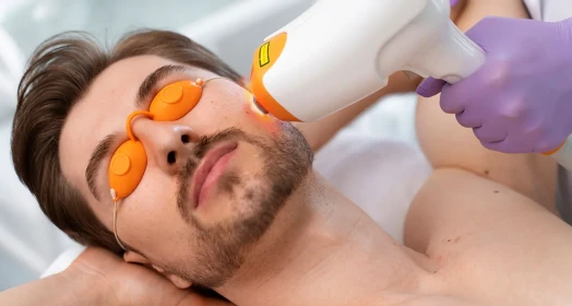 Upper Beard Hair Removal: Lasting Solutions for Men