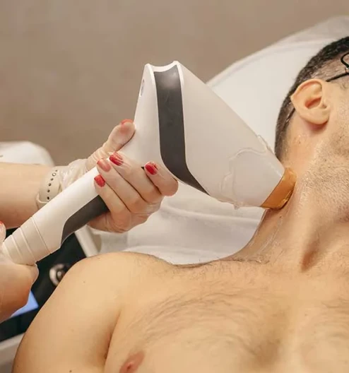 Painless Hair Removal for Men with Smart Diode Ice Laser