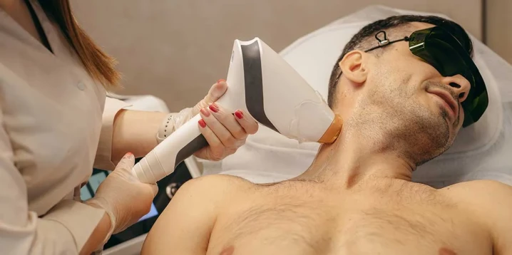 Painless Hair Removal for Men with Smart Diode Ice Laser