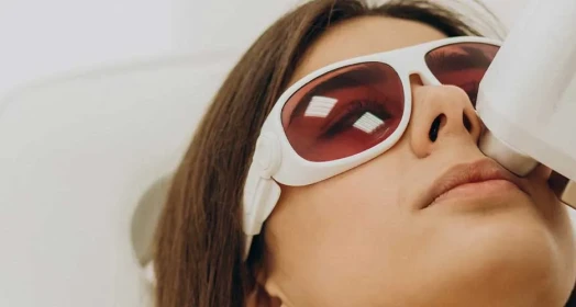 Yüz Epilasyon (Kadın)